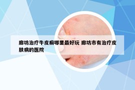 廊坊治療牛皮癬哪里最好玩 廊坊市有治療皮膚病的醫(yī)院