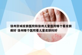 徐州京城皮膚醫(yī)院和徐州兒童醫(yī)院哪個看皮膚癬好 徐州哪個醫(yī)院看兒童皮膚科好