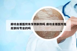 廊坊金盾醫(yī)院有生物制劑嗎 廊坊金盾醫(yī)院是皮膚科專業(yè)的嗎