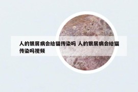 人的銀屑病會(huì)給貓傳染嗎 人的銀屑病會(huì)給貓傳染嗎視頻