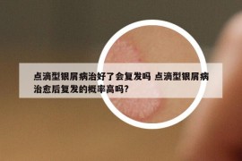 點(diǎn)滴型銀屑病治好了會(huì)復(fù)發(fā)嗎 點(diǎn)滴型銀屑病治愈后復(fù)發(fā)的概率高嗎?