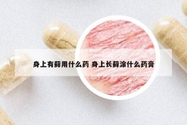 身上有蘚用什么藥 身上長蘚涂什么藥膏