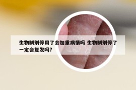 生物制劑停用了會(huì)加重病情嗎 生物制劑停了一定會(huì)復(fù)發(fā)嗎?