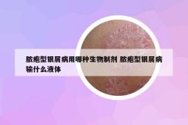 膿皰型銀屑病用哪種生物制劑 膿皰型銀屑病輸什么液體