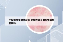 牛皮癬用克霉唑溶液 克霉唑乳膏治療銀屑病管用嗎