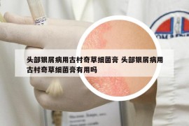 頭部銀屑病用古村奇草細菌膏 頭部銀屑病用古村奇草細菌膏有用嗎