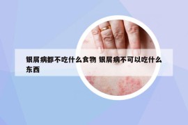 銀屑病都不吃什么食物 銀屑病不可以吃什么東西
