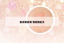 散狀銀屑病 銀屑散配方