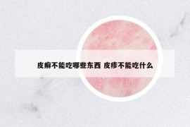 皮癬不能吃哪些東西 皮疹不能吃什么