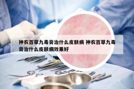 神農(nóng)百草九毒膏治什么皮膚病 神農(nóng)百草九毒膏治什么皮膚病效果好