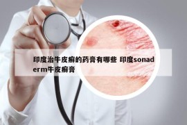 印度治牛皮癬的藥膏有哪些 印度sonaderm牛皮癬膏