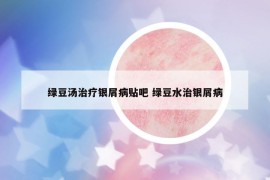 綠豆湯治療銀屑病貼吧 綠豆水治銀屑病