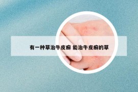 有一種草治牛皮癬 能治牛皮癬的草