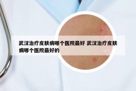 武漢治療皮膚病哪個醫(yī)院最好 武漢治療皮膚病哪個醫(yī)院最好的