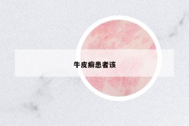 牛皮癬患者該