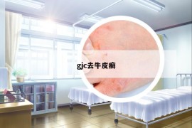gjc去牛皮癬