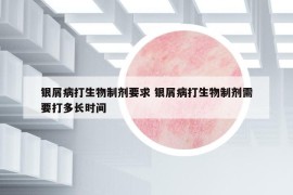 銀屑病打生物制劑要求 銀屑病打生物制劑需要打多長(zhǎng)時(shí)間