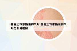 藿香正氣水能治腳氣嗎 藿香正氣水能治腳氣嗎怎么用視頻