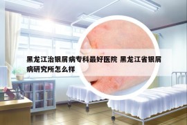 黑龍江治銀屑病?？谱詈冕t(yī)院 黑龍江省銀屑病研究所怎么樣