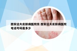 西安遠大皮膚病醫(yī)院找 西安遠大皮膚病醫(yī)院電話號碼是多少