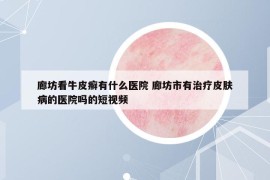 廊坊看牛皮癬有什么醫(yī)院 廊坊市有治療皮膚病的醫(yī)院?jiǎn)岬亩桃曨l