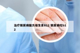 治療銀屑病偏方維生素B12 銀屑病吃b12