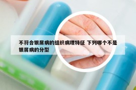 不符合銀屑病的組織病理特征 下列哪個不是銀屑病的分型