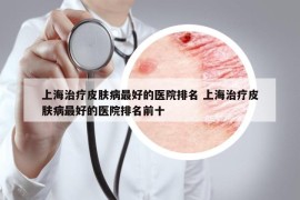 上海治療皮膚病最好的醫(yī)院排名 上海治療皮膚病最好的醫(yī)院排名前十
