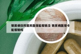 銀屑病住院居民醫(yī)保能報銷沒 銀屑病醫(yī)?？軋箐N嗎