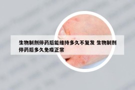生物制劑停藥后能維持多久不復(fù)發(fā) 生物制劑停藥后多久免疫正常