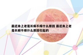 最近身上老是長癬不癢什么原因 最近身上老是長癬不癢什么原因引起的