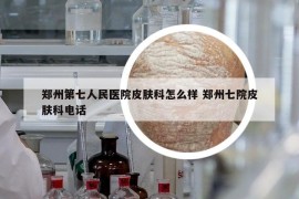 鄭州第七人民醫(yī)院皮膚科怎么樣 鄭州七院皮膚科電話