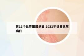 第12個世界銀屑病日 2021年世界銀屑病日