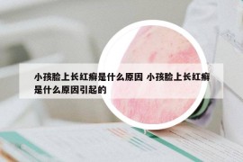 小孩臉上長紅癬是什么原因 小孩臉上長紅癬是什么原因引起的