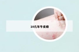 10幾年牛皮癬