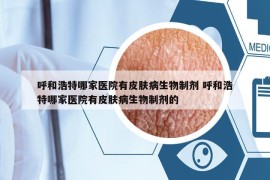 呼和浩特哪家醫(yī)院有皮膚病生物制劑 呼和浩特哪家醫(yī)院有皮膚病生物制劑的