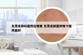 東莞皮膚科醫(yī)院在哪里 東莞皮膚醫(yī)院哪個醫(yī)院最好