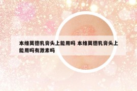本維莫德乳膏頭上能用嗎 本維莫德乳膏頭上能用嗎有激素嗎