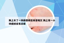 胸上長(zhǎng)了一塊癬很癢后來(lái)變暗沉 胸上有一小塊癬掉皮有點(diǎn)癢