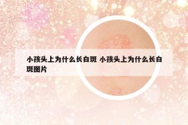 小孩頭上為什么長白斑 小孩頭上為什么長白斑圖片