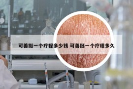 可善挺一個療程多少錢 可善挺一個療程多久