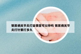 銀屑病關節(jié)炎打益賽普可以停嗎 銀屑病關節(jié)炎打針要打多久