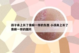 孩子身上長了像癬一樣的東西 小孩身上長了像癬一樣的圖片