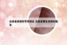云南省皮膚科專家排名 云南省著名皮膚科醫(yī)生