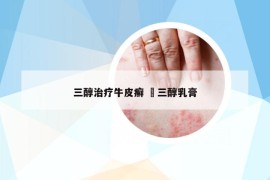 三醇治療牛皮癬 ?三醇乳膏