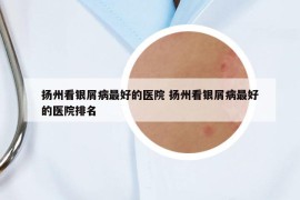 揚(yáng)州看銀屑病最好的醫(yī)院 揚(yáng)州看銀屑病最好的醫(yī)院排名