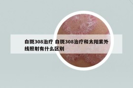 白斑308治療 白斑308治療和太陽紫外線照射有什么區(qū)別