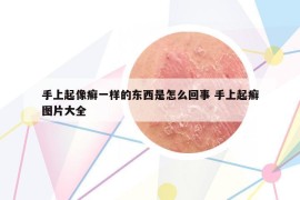 手上起像癬一樣的東西是怎么回事 手上起癬圖片大全