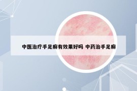 中醫(yī)治療手足癬有效果好嗎 中藥治手足癬