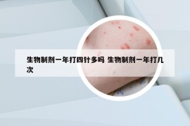 生物制劑一年打四針多嗎 生物制劑一年打幾次
